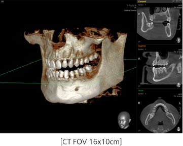 CT FOV 16x10cm