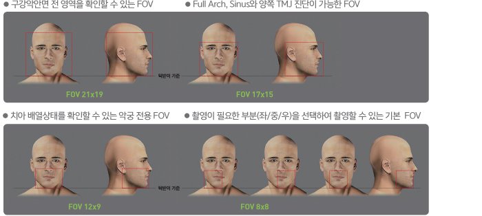 구강악안면 전 영역을 확인할 수 있는 FOV, Full Arch, Sinus와 양쪽 TMJ 진단이 가능한 FOV, 치아 배열상태를 확인할 수 있는 악궁 전용FOV, 촬영이 필요한 부분(좌/중/우)을 선택하여 촬영할 수 있는 기본FOV 이미지