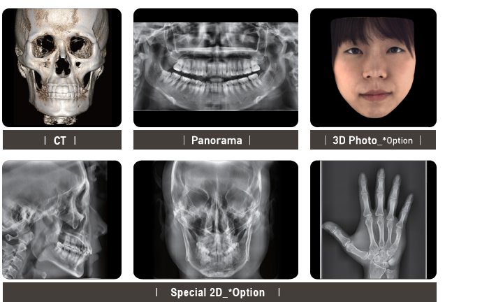 CT, Panorama, Cephalo, 3D Photo 사진