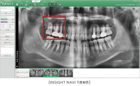 INSIGHT NAVI 기본화면