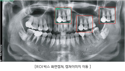 ROI 박스 화면캡쳐, 캡쳐이미지이동 사진