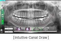 Intuitive Canal Draw 화면