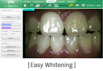 Easy Whitening 화면
