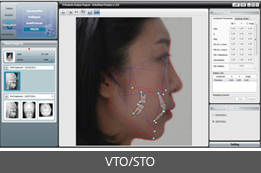 VTO/STO 화면 이미지