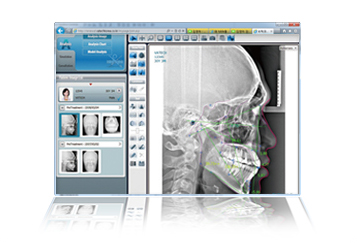 OrthoVision 제품이미지